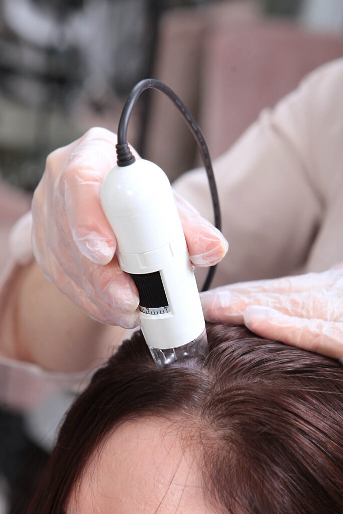 An image of hair loss and scalp health services from Carnaby Street Hairdressers.